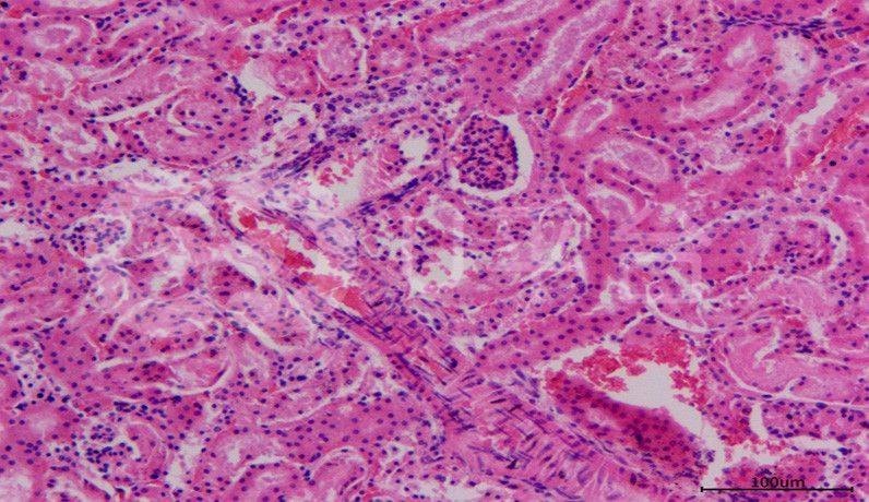 HE染色-普拉特澤