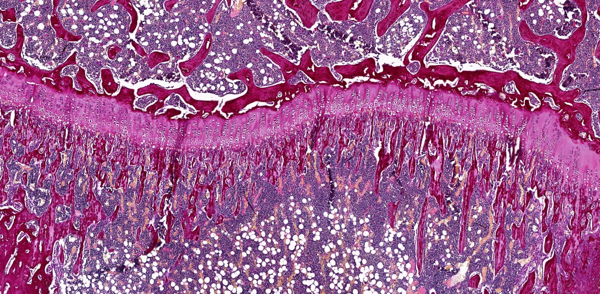 番紅O染色—關(guān)節(jié)