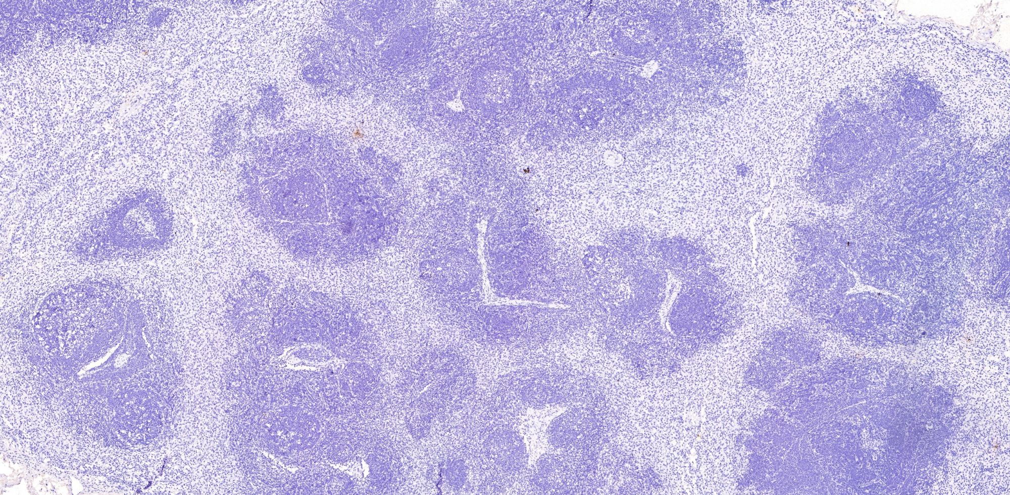 甲苯胺藍(lán)-淋巴