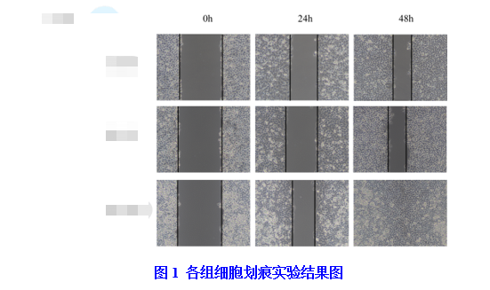 細(xì)胞劃痕實驗