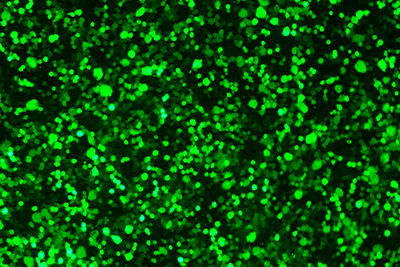LV-OE-NC細(xì)胞轉(zhuǎn)染感染