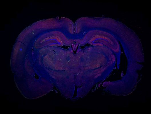 小鼠大腦免疫熒光染色