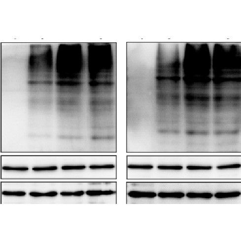 細(xì)胞CO-IP泛素化檢測