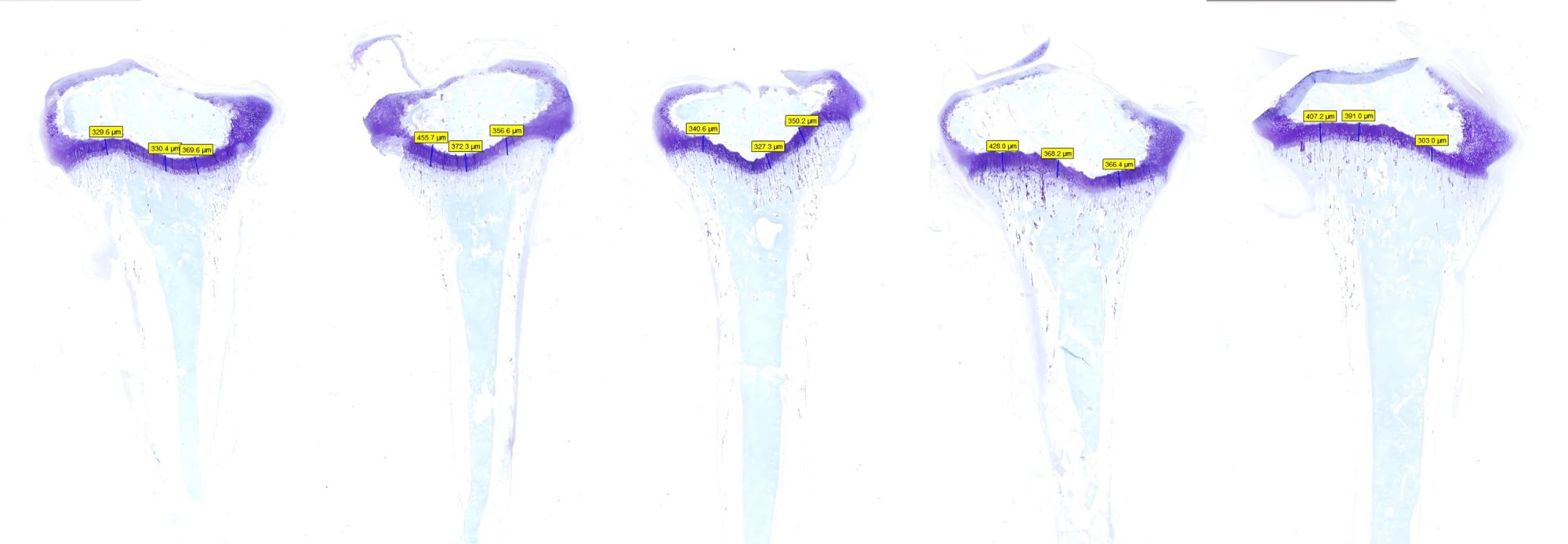 阿利新藍染色骨組織+測量