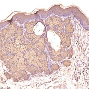 免疫組化染色口腔潰瘍