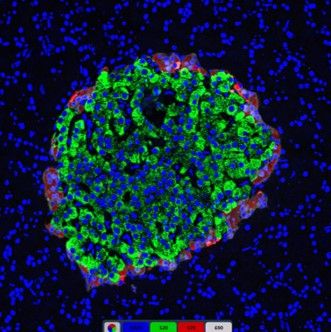 免疫熒光三標(biāo)胰島組織
