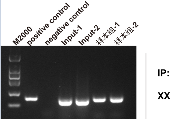 chip實(shí)驗(yàn)操作步驟