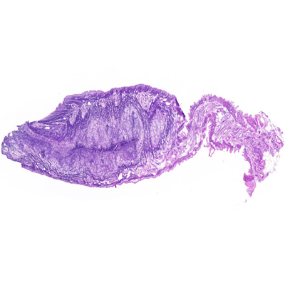 小鼠子宮HE染色